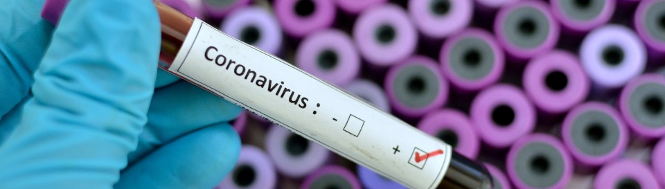 Auf dem Bild erkennt man ein positives Testergebnis für das Coronavirus